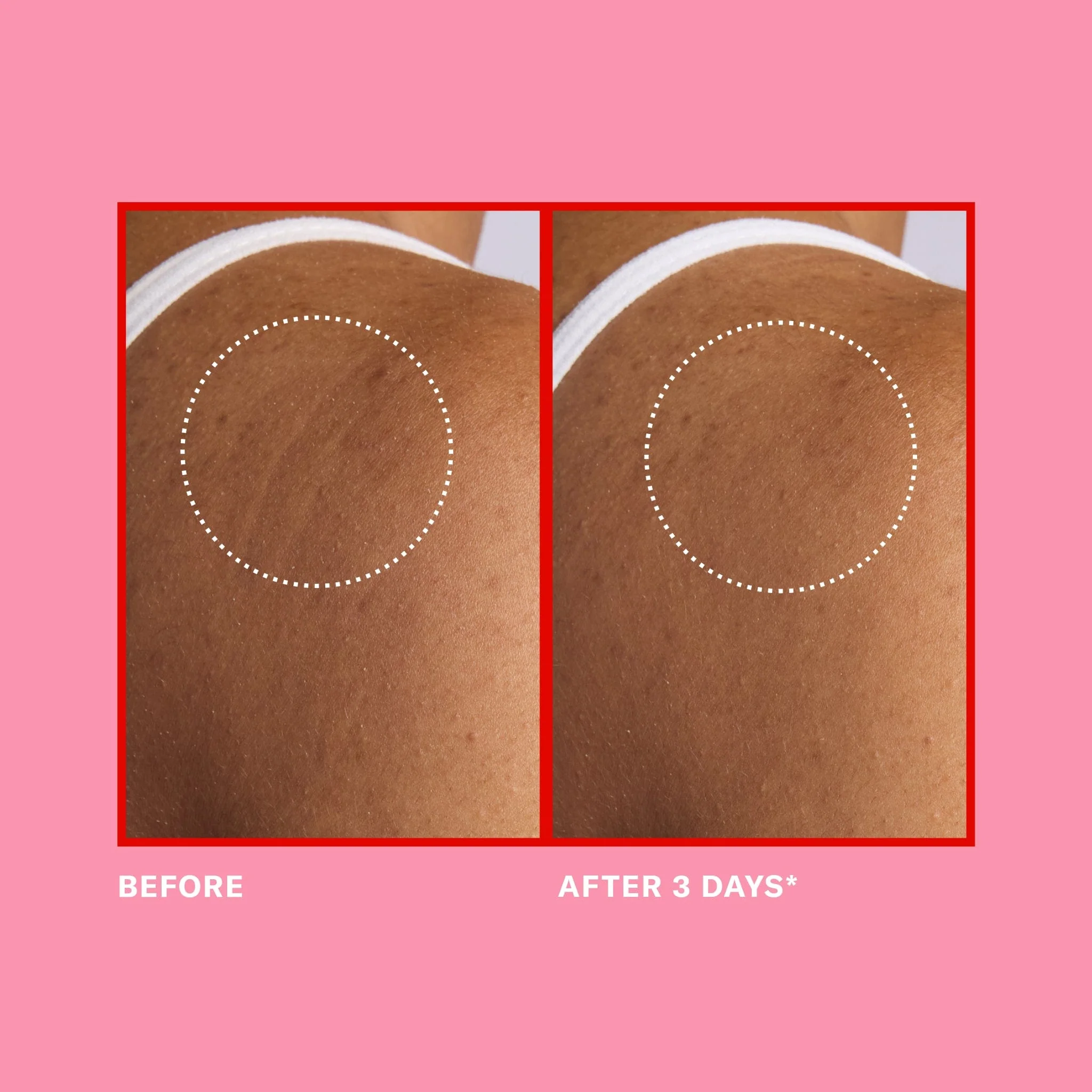 Pink Algae Pro-Retinol Body Butter - Image 4